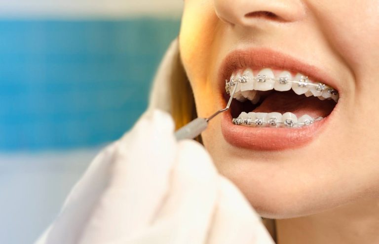 Best Orthodontist Services in Schwabing for All Age Patients